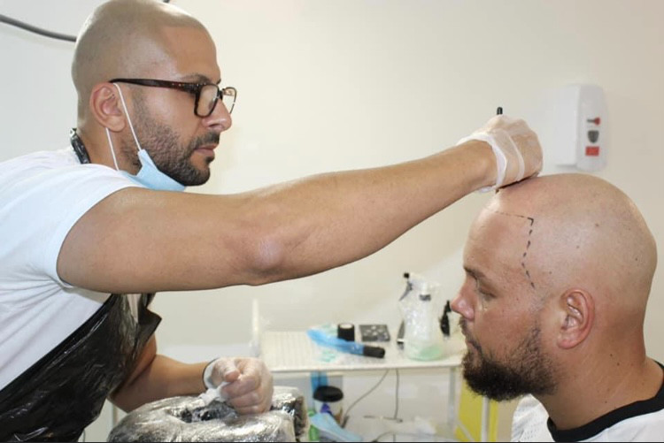 Best clinics for scalp micropigmentation in Lambeth, London